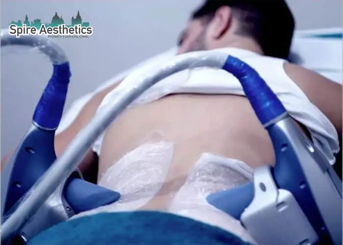 Man having fat freezing treatment done on love handles before a competitions Airdrie to create a sculpted look.