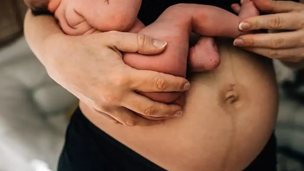 Why Is My Stomach Still Big After Pregnancy Airdrie?